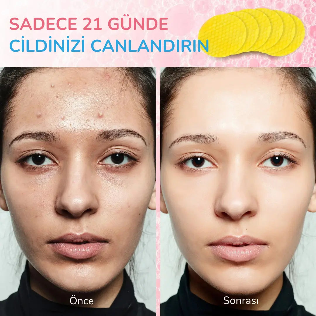 EsilaCare™ Kojik Asit & Zerdeçal Temizleme Pedleri