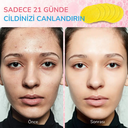 EsilaCare™ Kojik Asit & Zerdeçal Temizleme Pedleri