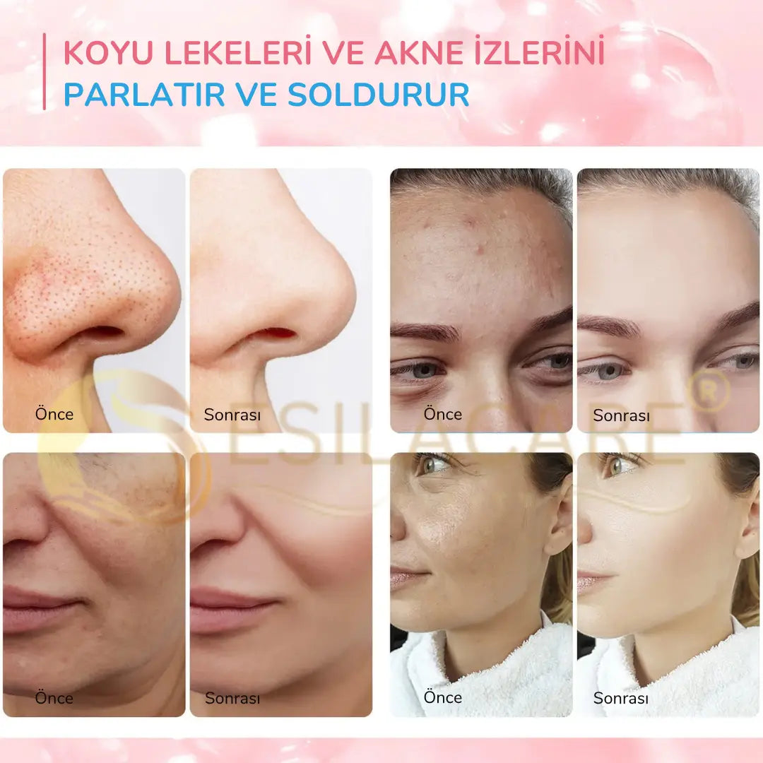 EsilaCare™ Kojik Asit & Zerdeçal Temizleme Pedleri