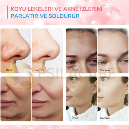 EsilaCare™ Kojik Asit & Zerdeçal Temizleme Pedleri